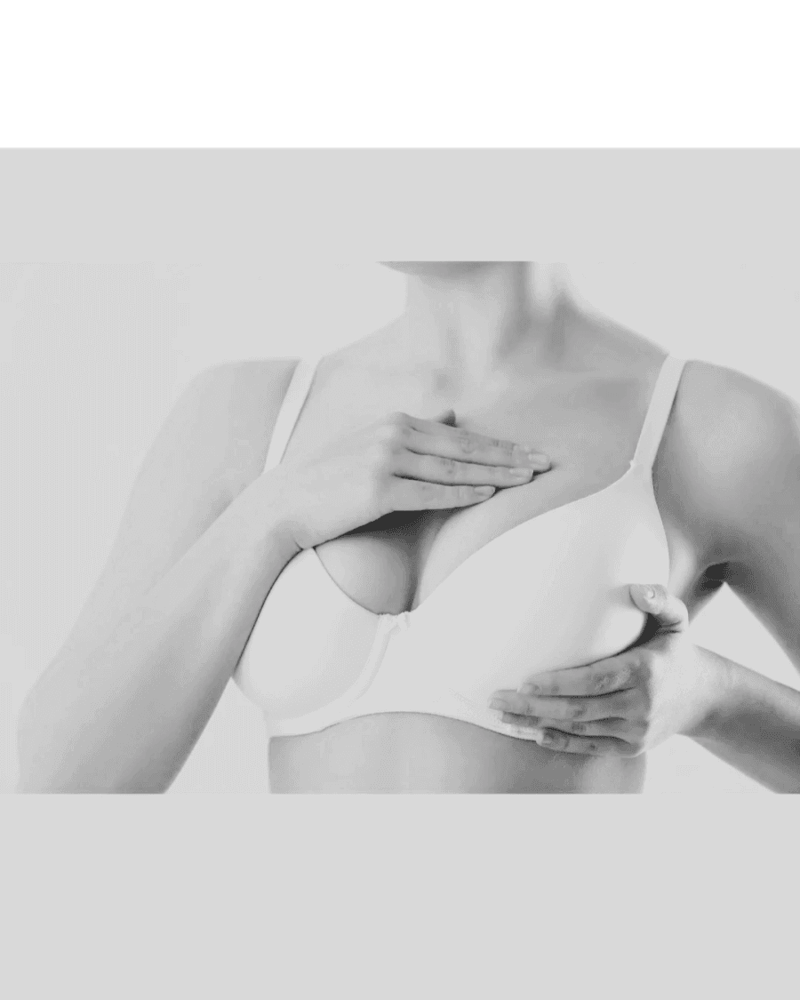 Woman in white bra representing breast implant exchange