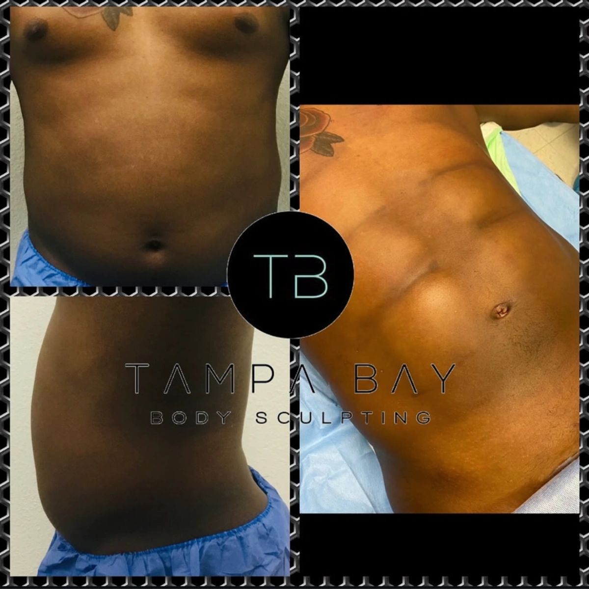 Before and after body sculpting showing 6 pack ab sculpting and a toned, defined abdomen.