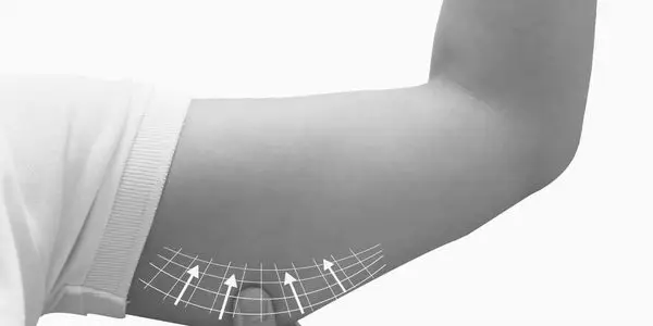 Woman representing arm contouring consultation in Tampa Bay