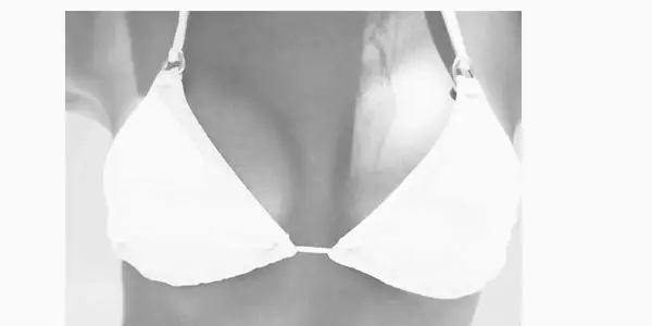 Woman representing breast rejuvenation consultation in Tampa Bay