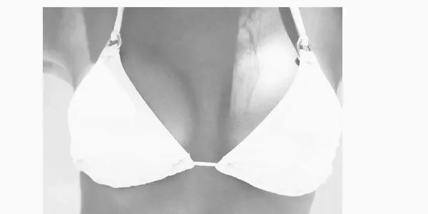 Breast rejuvenation procedure